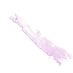 Human FFPE NAT Skin Tissue HuN-22-0144B