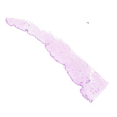 Human FFPE NAT Skin Tissue HuN-22-0146B