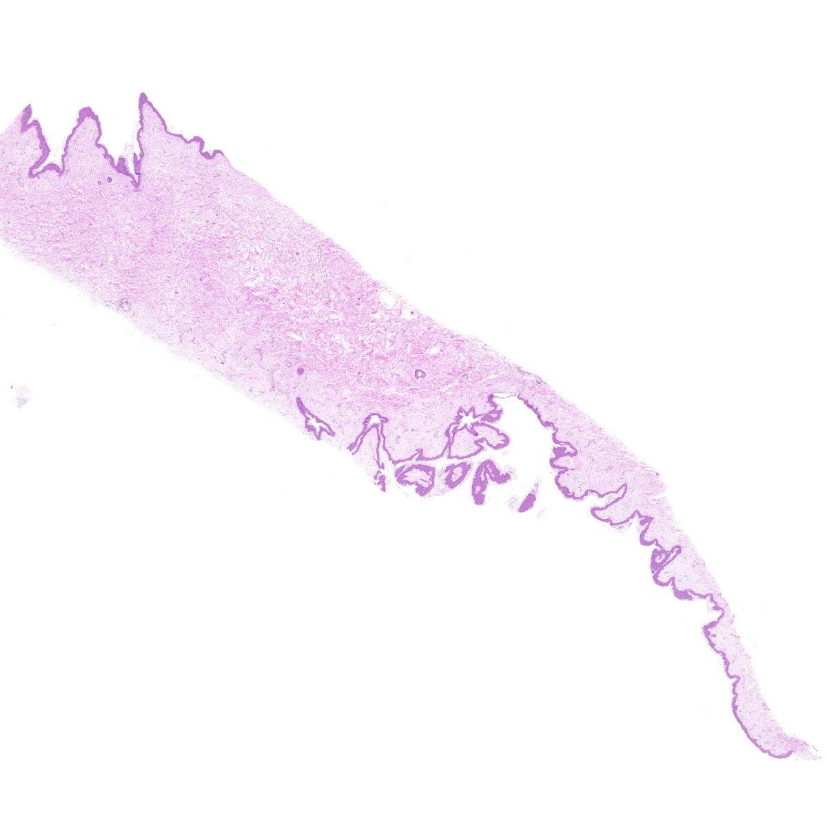Human FFPE NAT Skin Tissue HuN-22-0147B