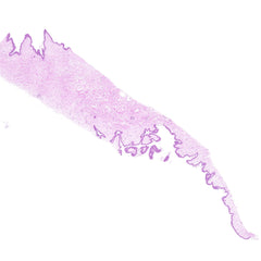 Human FFPE NAT Skin Tissue HuN-22-0147B