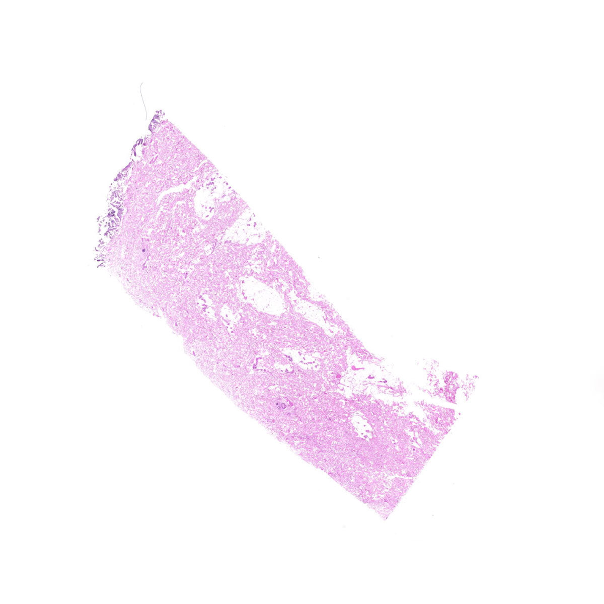 Human FFPE NAT Skin Tissue HuN-22-0148B