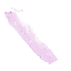 Human FFPE NAT Skin Tissue HuN-22-0149A
