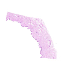 Human FFPE NAT Skin Tissue HuN-22-0149B