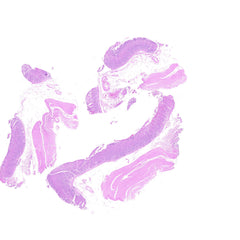 Human FFPE NAT Stomach Tissue HuN-24-0014