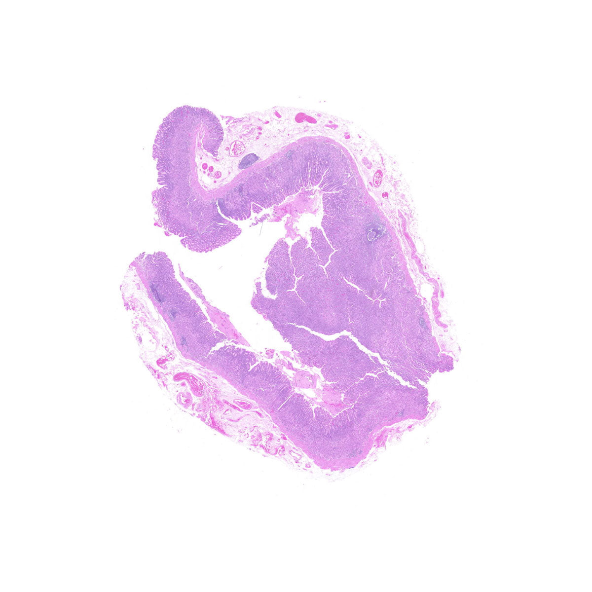 Human FFPE NAT Stomach Tissue HuN-24-0016