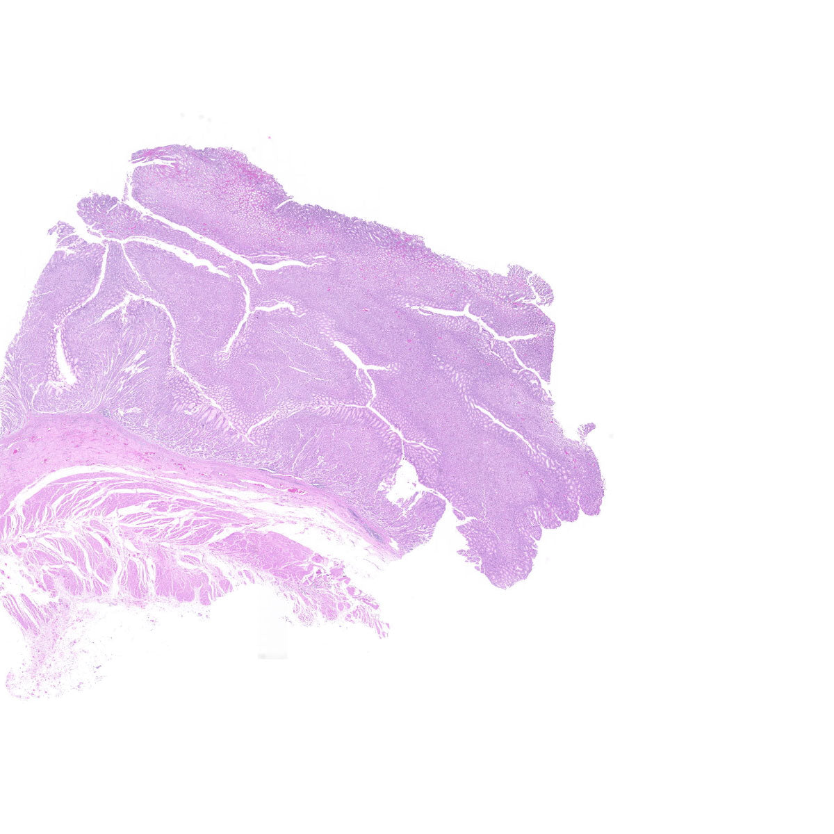 Human FFPE NAT Stomach Tissue HuN-24-0019