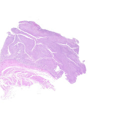 Human FFPE NAT Stomach Tissue HuN-24-0019