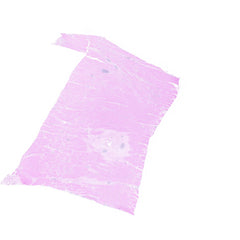 Human FFPE NAT Stomach Tissue HuN-24-0020