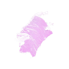 Human FFPE NAT Stomach Tissue HuN-24-0022
