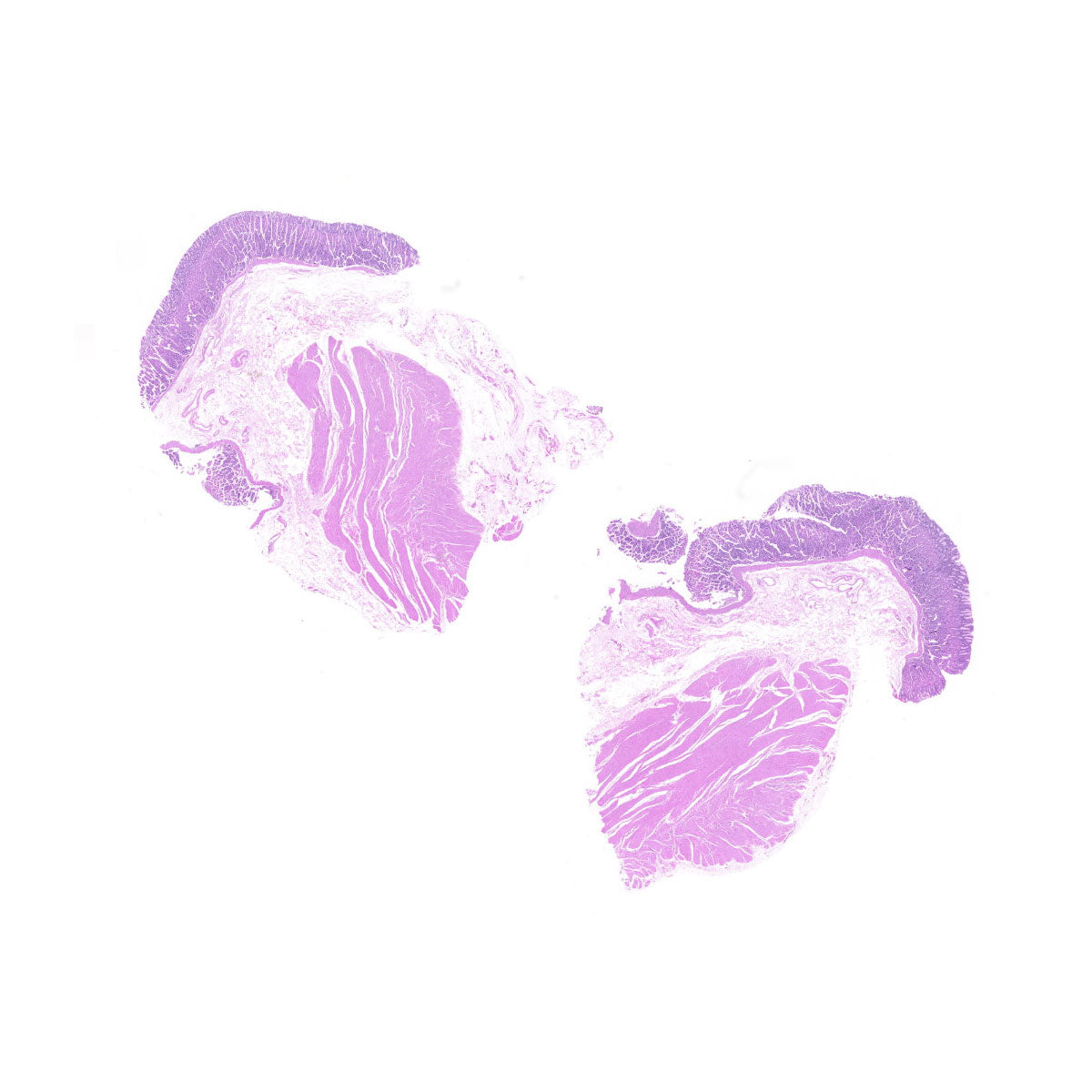 Human FFPE NAT Stomach Tissue HuN-24-0025