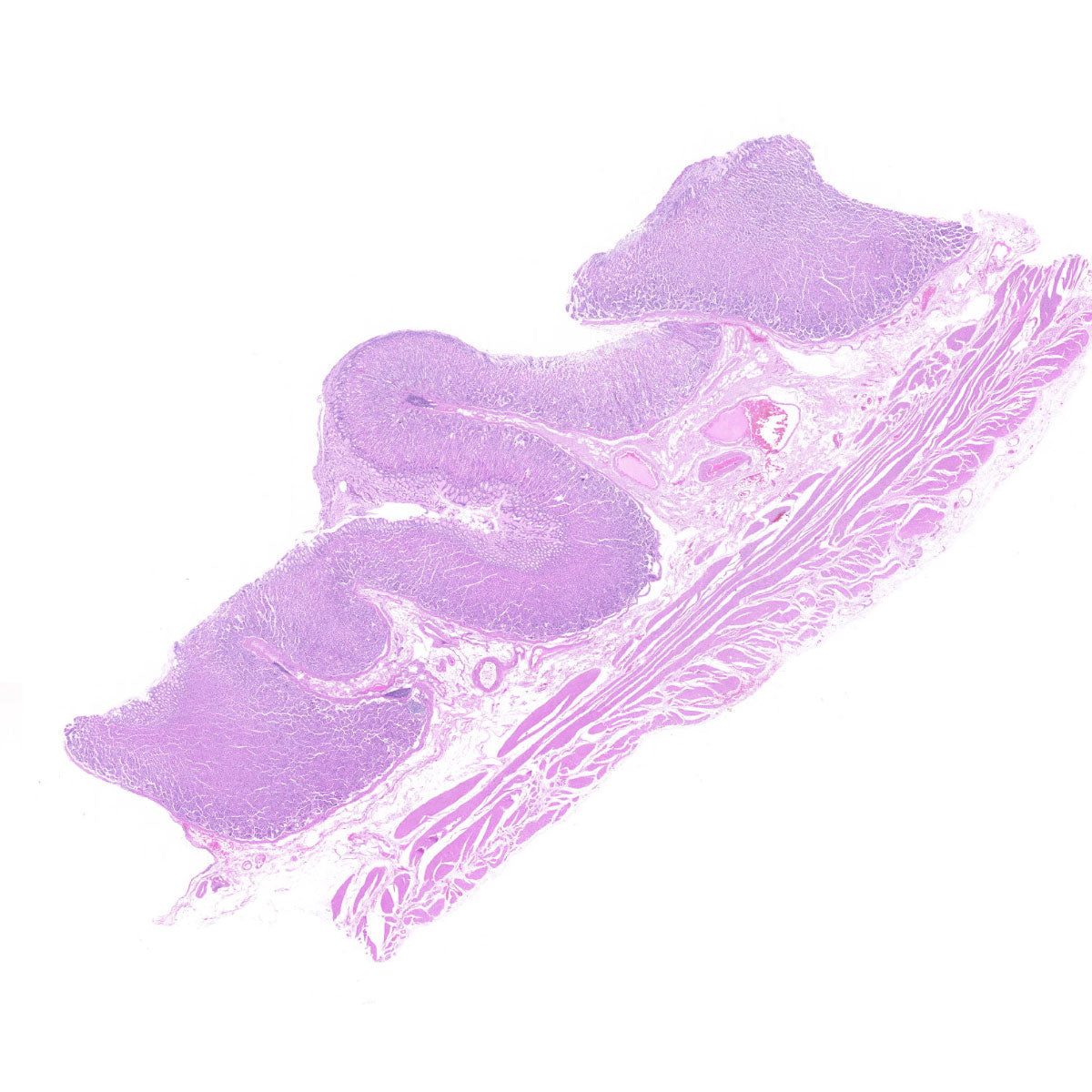 Human FFPE NAT Stomach Tissue HuN-24-0026