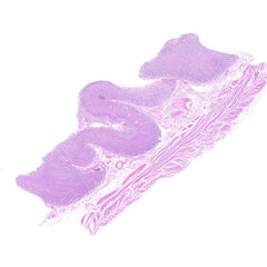 Human FFPE NAT Stomach Tissue HuN-24-0026