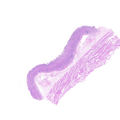 Human FFPE NAT Stomach Tissue HuN-24-0030