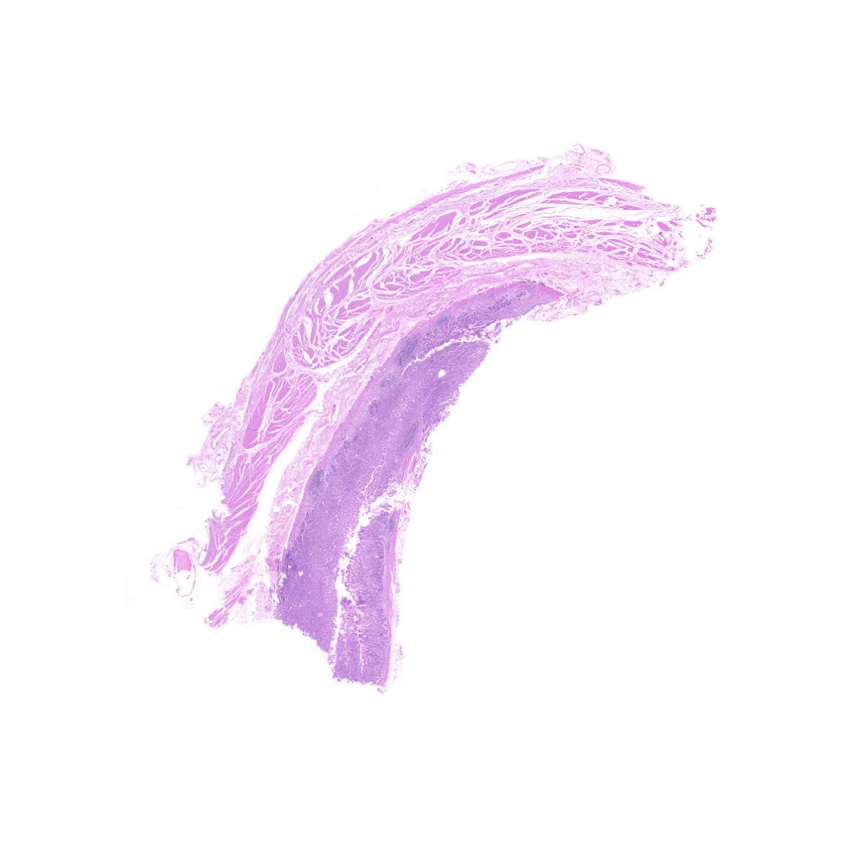 Human FFPE NAT Stomach Tissue HuN-24-0031