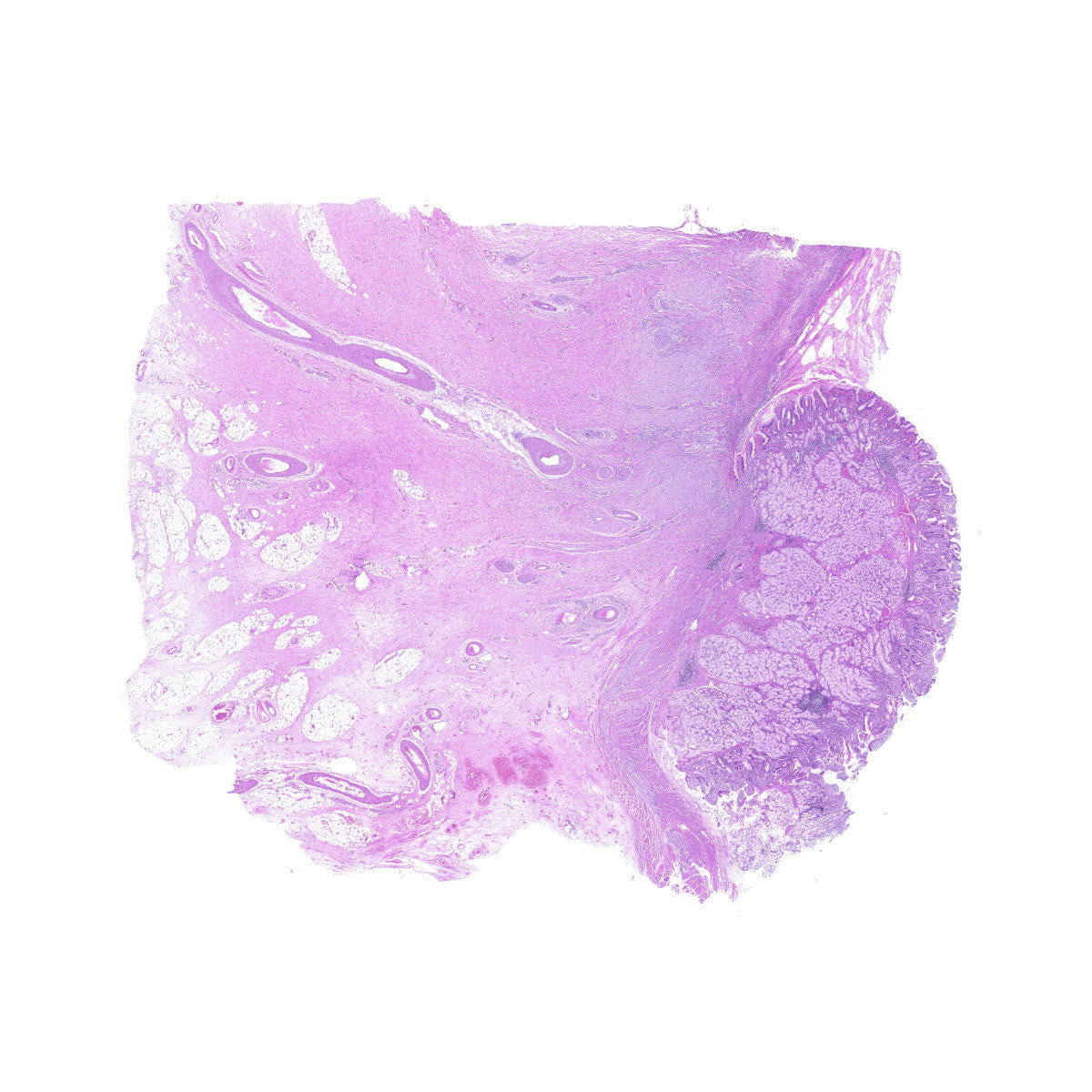 Human FFPE NAT Stomach Tissue HuN-24-0032A