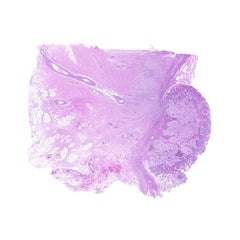 Human FFPE NAT Stomach Tissue HuN-24-0032A
