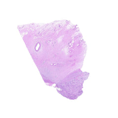 Human FFPE NAT Stomach Tissue HuN-24-0032B
