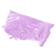 Human FFPE NAT Stomach Tissue HuN-24-0035A