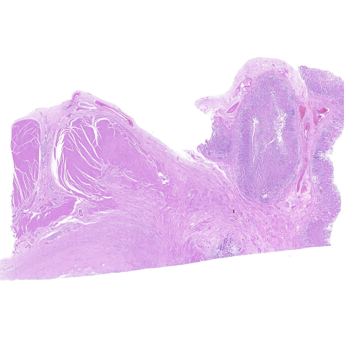 Human FFPE NAT Stomach Tissue HuN-24-0035B