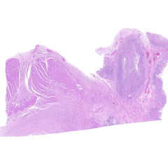 Human FFPE NAT Stomach Tissue HuN-24-0035B
