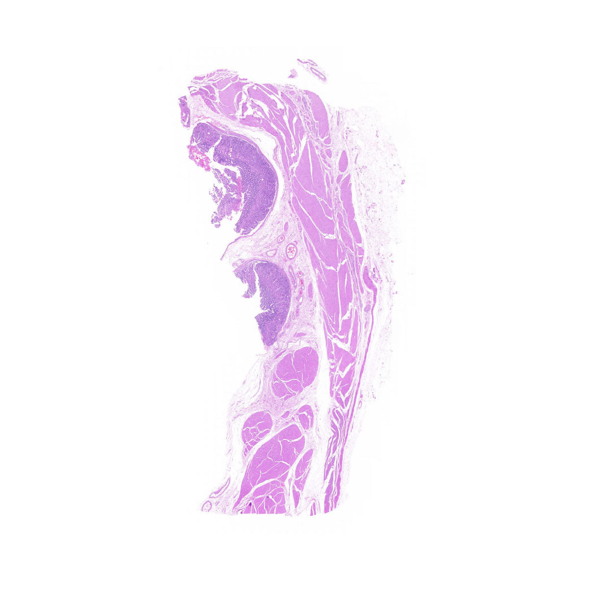 Human FFPE NAT Stomach Tissue HuN-24-0038