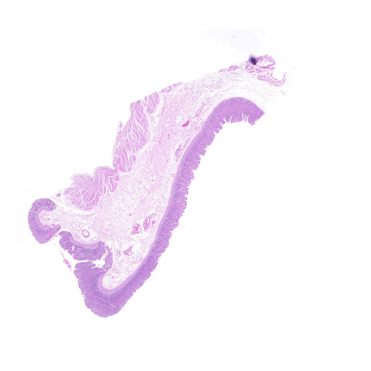 Human FFPE NAT Stomach Tissue HuN-24-0039
