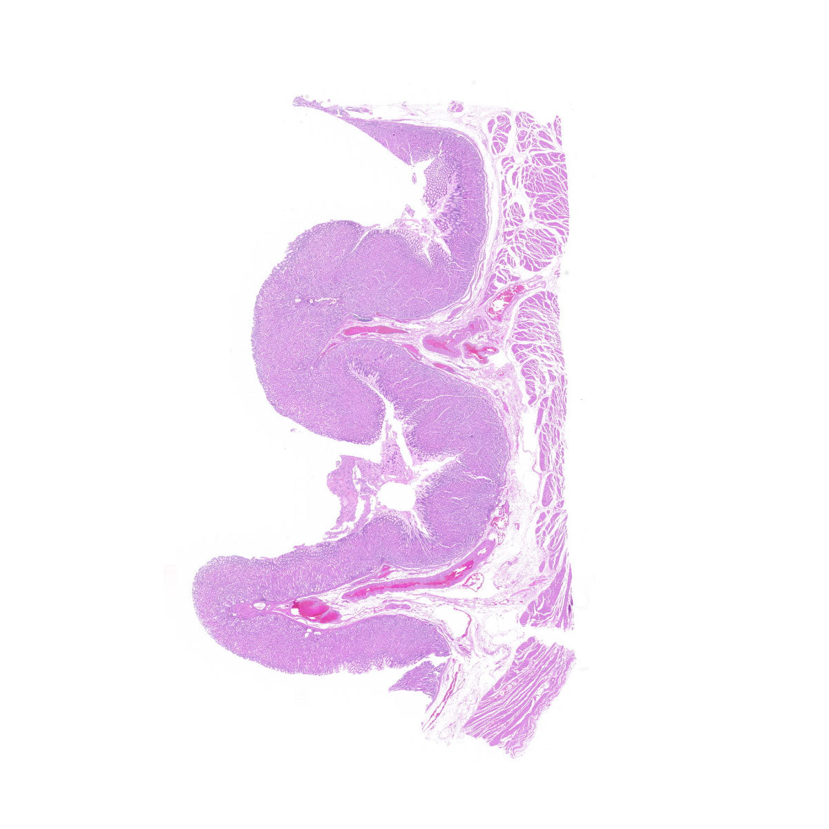 Human FFPE NAT Stomach Tissue HuN-24-0040