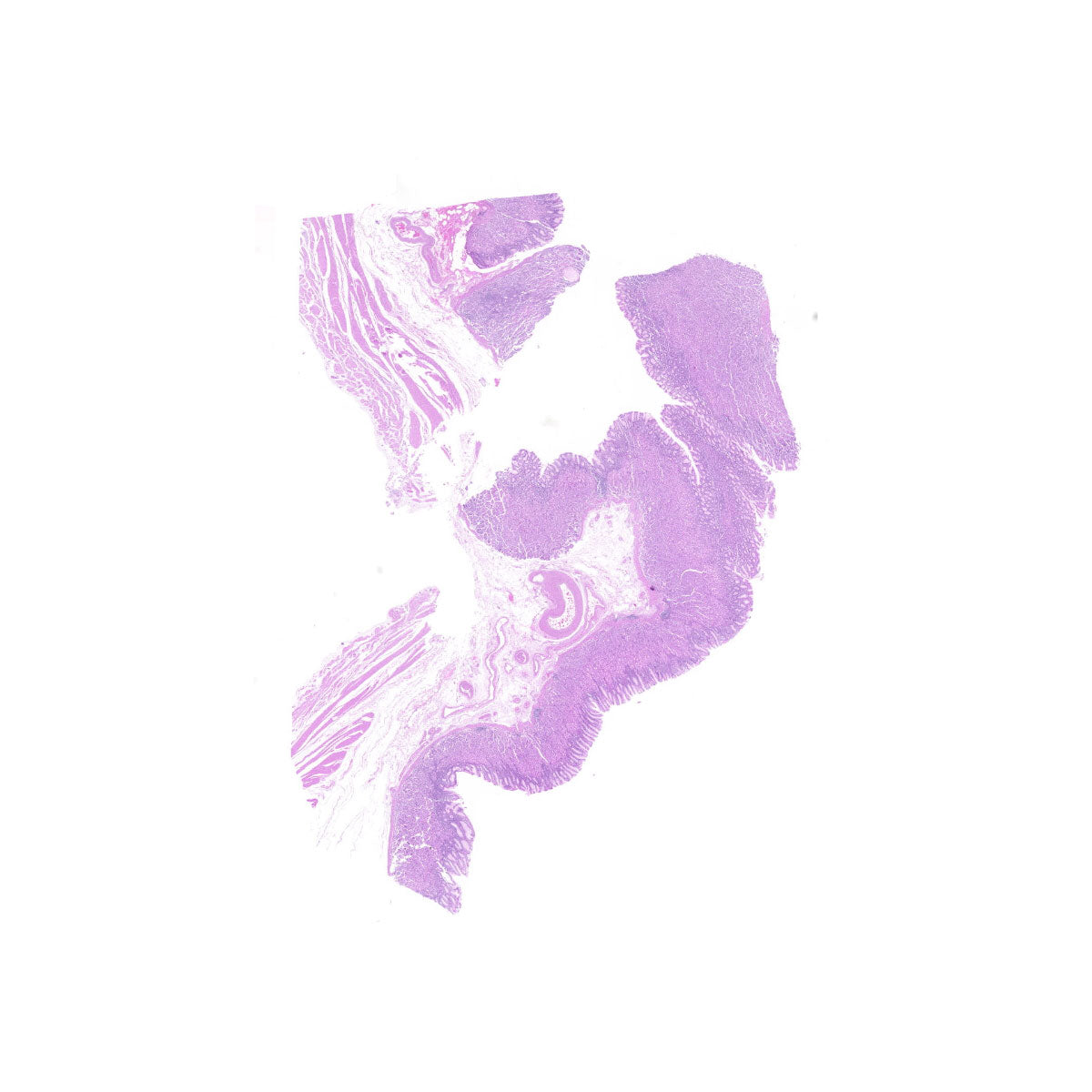Human FFPE NAT Stomach Tissue HuN-24-0041A