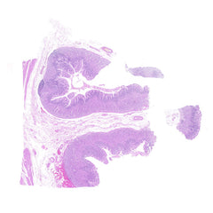 Human FFPE NAT Stomach Tissue HuN-24-0041B