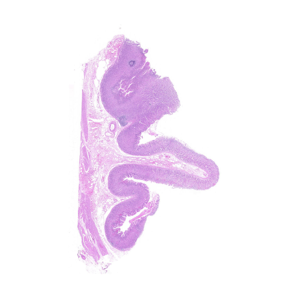 Human FFPE NAT Stomach Tissue HuN-24-0042