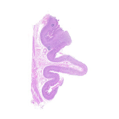 Human FFPE NAT Stomach Tissue HuN-24-0042