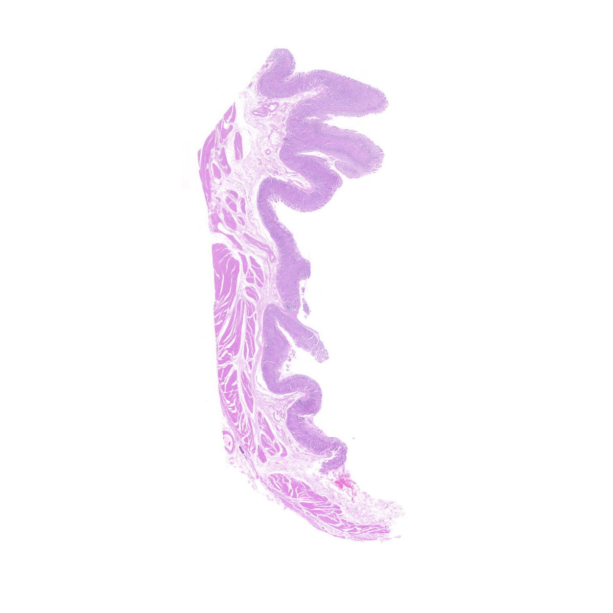 Human FFPE NAT Stomach Tissue HuN-24-0044