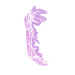 Human FFPE NAT Stomach Tissue HuN-24-0044