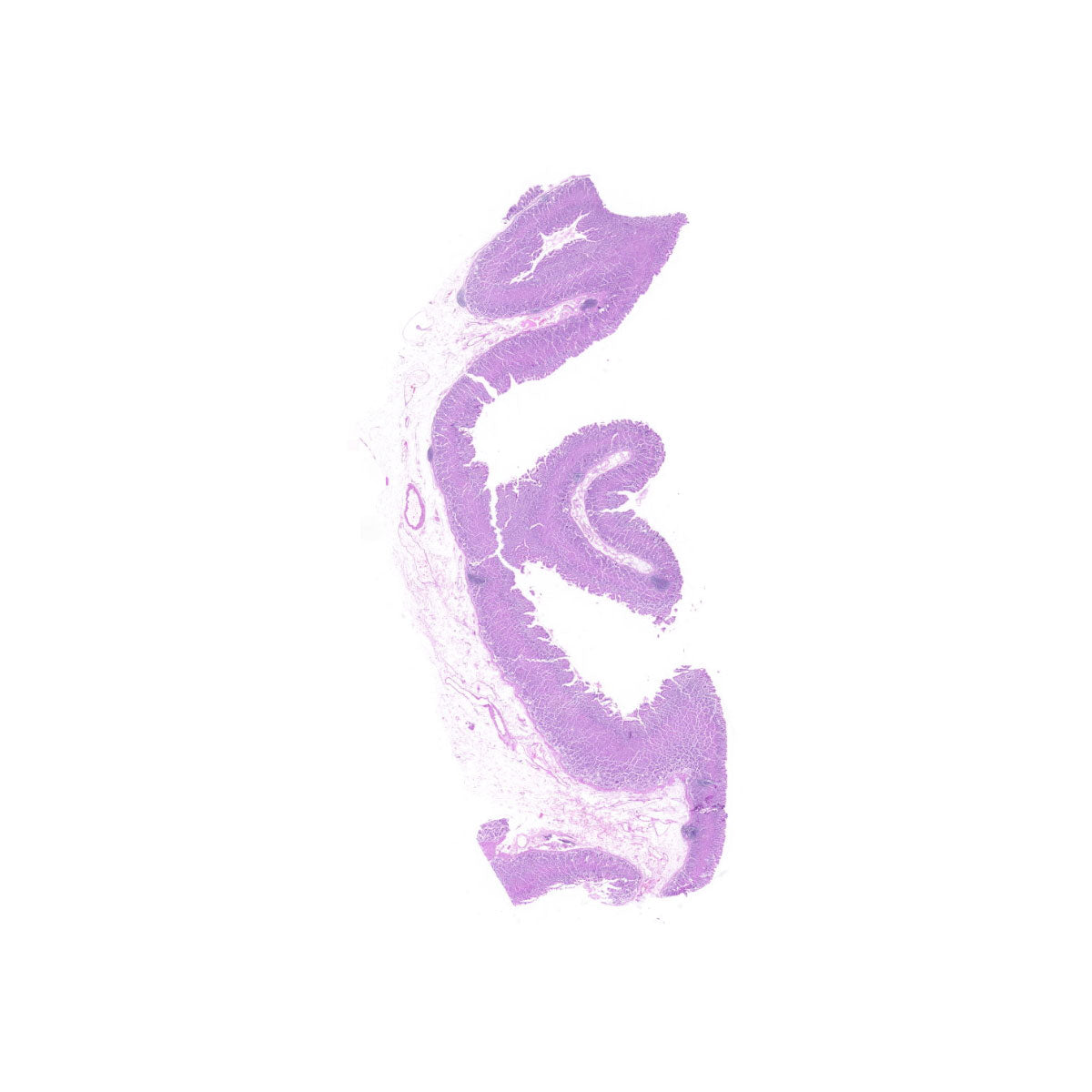 Human FFPE NAT Stomach Tissue HuN-24-0045