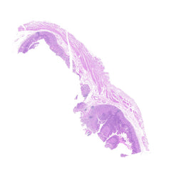 Human FFPE NAT Stomach Tissue HuN-24-0046
