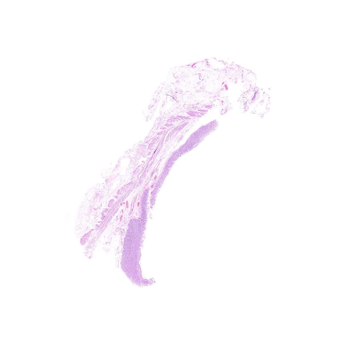 Human FFPE NAT Stomach Tissue HuN-24-0047