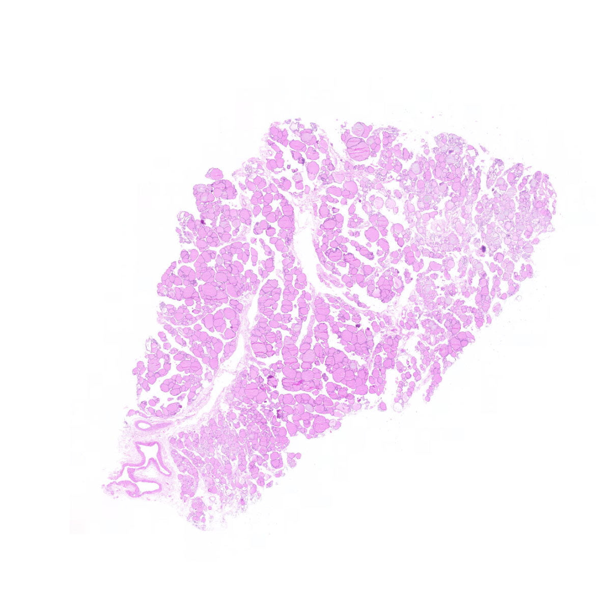 Human FFPE NAT Thyroid Tissue HuN-25-0007