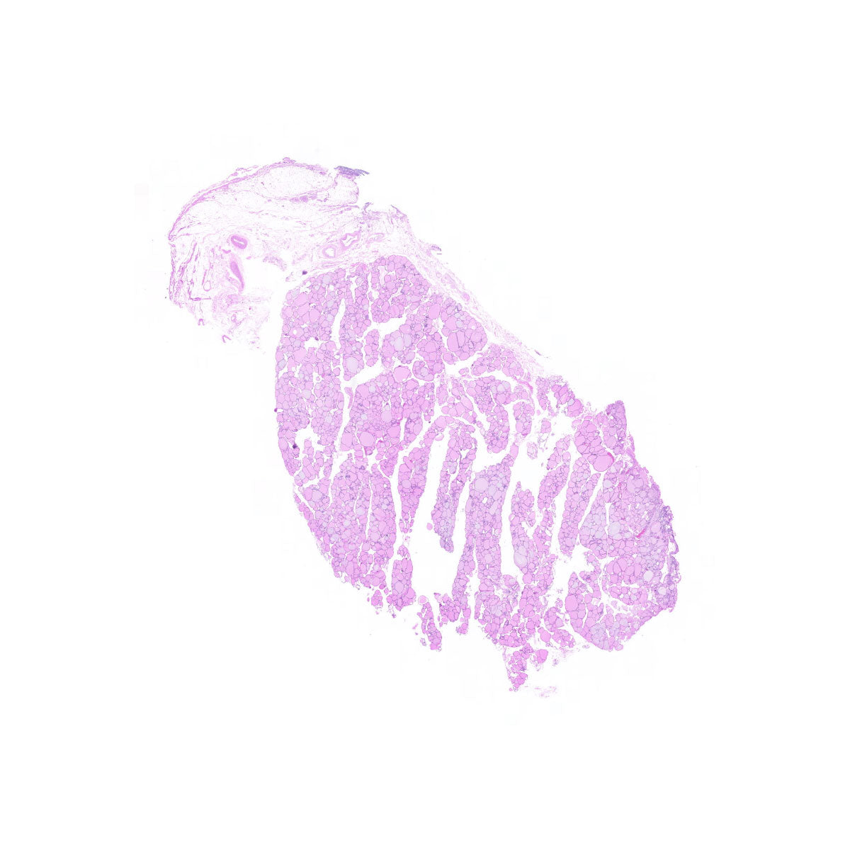 Human FFPE NAT Thyroid Tissue HuN-25-0008
