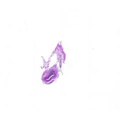 Human FFPE NAT Thyroid Tissue HuN-25-0012