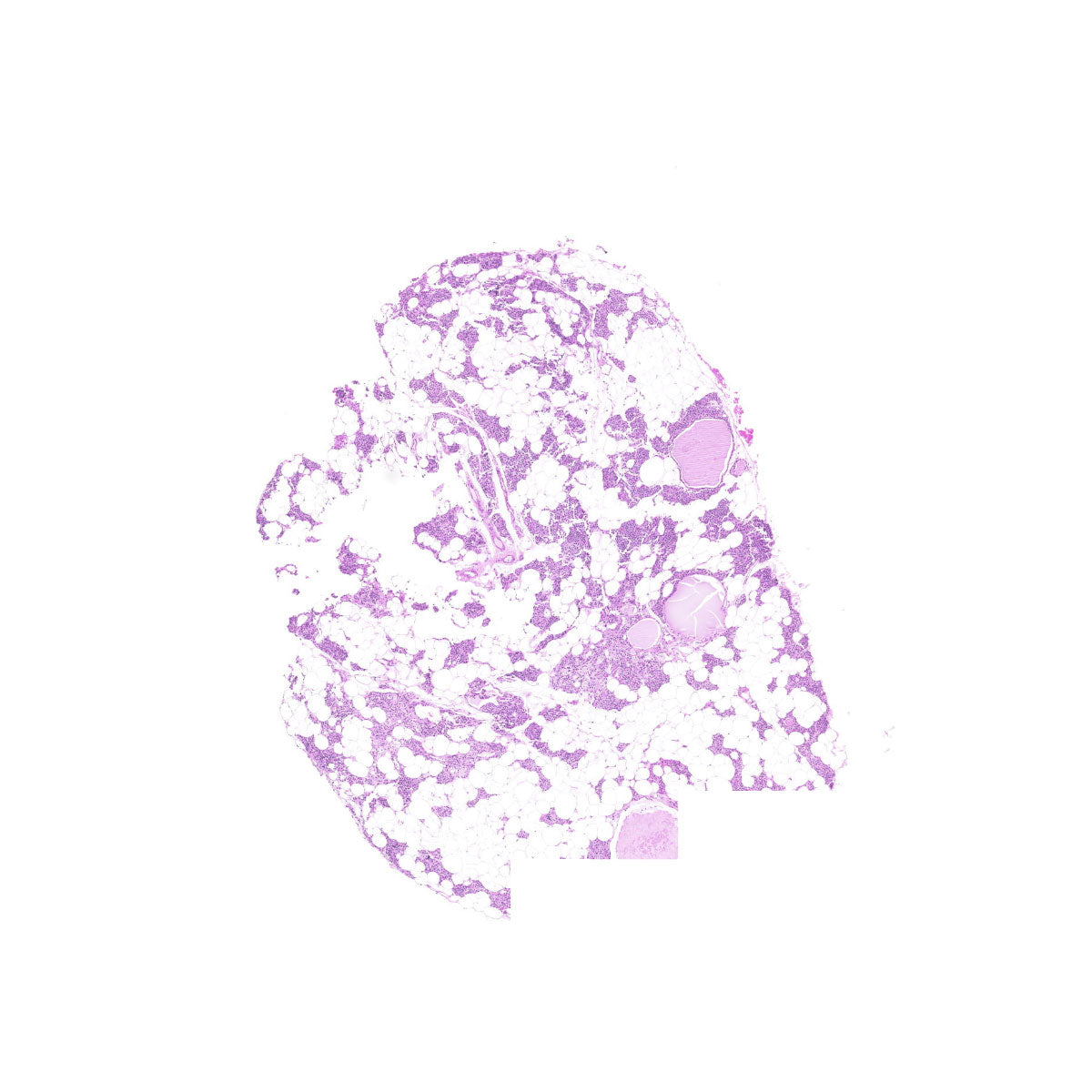 Human FFPE NAT Thyroid Tissue HuN-25-0017