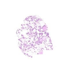 Human FFPE NAT Thyroid Tissue HuN-25-0017