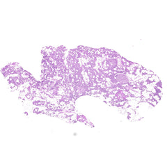 Human FFPE NAT Thyroid Tissue HuN-25-0019