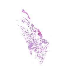 Human FFPE NAT Thyroid Tissue HuN-25-0020