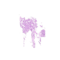 Human FFPE NAT Thyroid Tissue HuN-25-0021
