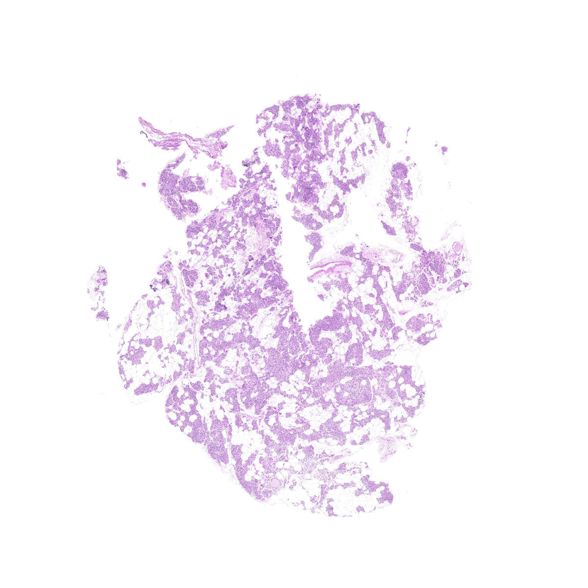Human FFPE NAT Thyroid Tissue HuN-25-0022