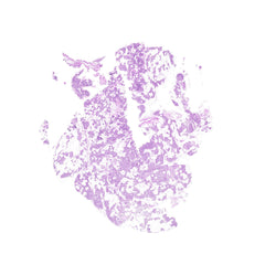 Human FFPE NAT Thyroid Tissue HuN-25-0022