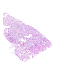 Human FFPE NAT Testis Tissue HuN-27-0011