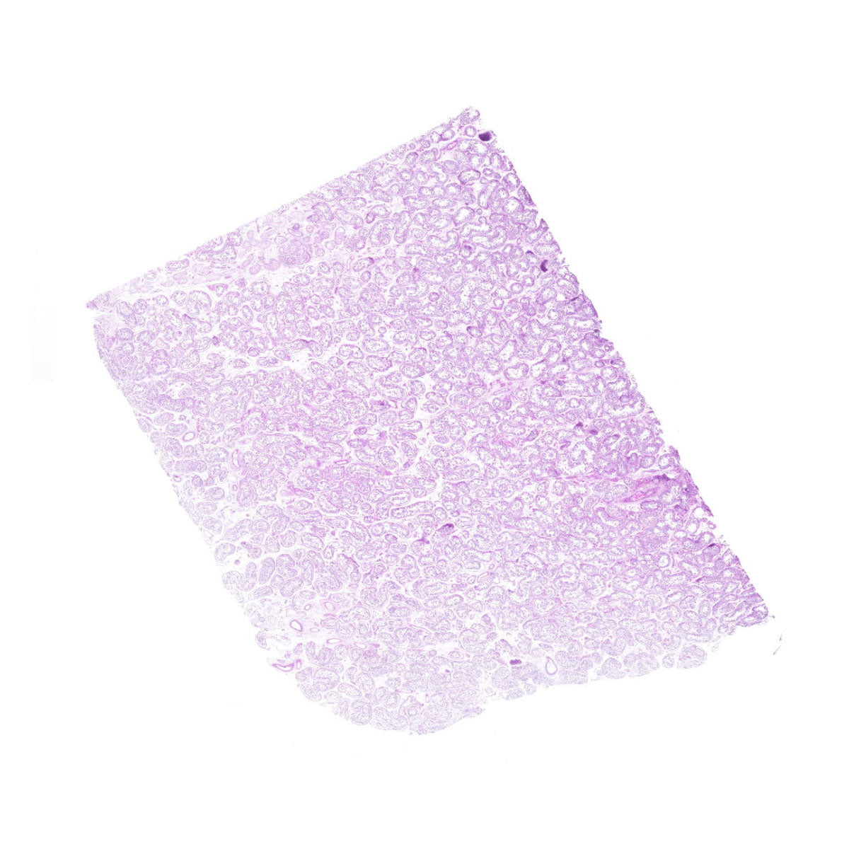 Human FFPE NAT Testis Tissue HuN-27-0017B