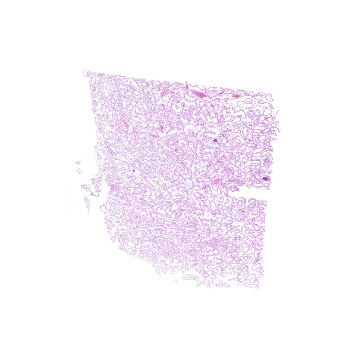 Human FFPE NAT Testis Tissue HuN-27-0020A