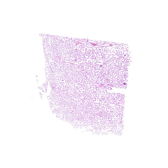 Human FFPE NAT Testis Tissue HuN-27-0020A